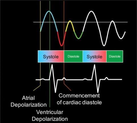 Figure 6 Spectral Doppler tracing correlated with the cardiac cycle by means of concurrent ECG tracing. Hình 6 Dấu phổ Doppler tương quan với chu kỳ tim bằng cách ghi ECG đồng thời.