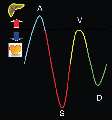 Hình 4 Các biểu đồ dòng máu chảy qua tim phải và ảnh hưởng của nó lên dạng sóng phổ Doppler. Mảnh ghép phổ cho thấy một phần của dạng sóng hình thành bởi mỗi phần của chu kỳ tim.