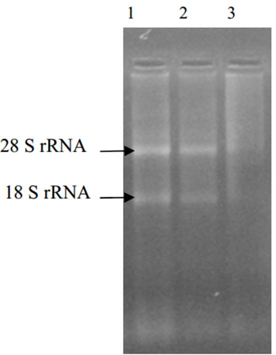 N ((2 6B.?! RNA vj! h. # BK 0* 8 vj 01RNA. 28 S * 18 S 01$ 2 'C.
