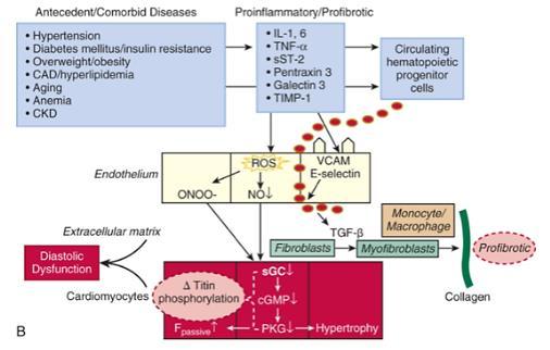 Pathophysiologic mechanisms underlying the development of HFpEF(2 ) Antecedent/Comorbid Dieases Proinflammatory/Profibrotic Hypertension Diabetes mellitus/insulin resistance Overweight/Obesity
