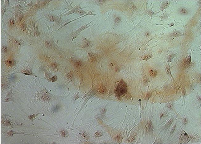 12 13 Biệt hóa MSC thành tế bào tạo mỡ sau 5-7 ngày ( x500). Nhuộm Oil red O. Các giọt mỡ bắt màu đỏ ( x 500). Hình 3.6. Hình ảnh tế bào gốc trung mô biệt hóa thành tế bào mỡ 3.1.7. Kết quả biệt hóa tế bào gốc trung mô thành tạo cốt bào Sau khi nuôi cấy với môi trường cảm ứng biệt hóa 4 ngày, tế bào có sự thay đổi hình dạng nhẹ.