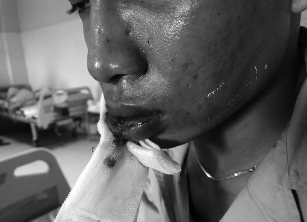 Trên nét mặt của ông Phan Anh Tuấn, chủ quán hủ tiếu cà phê Tuấn Anh, một nạn nhân của băng nhóm giang hồ đòi tiền bảo kê vẫn chưa hết nét bàng hoàng.