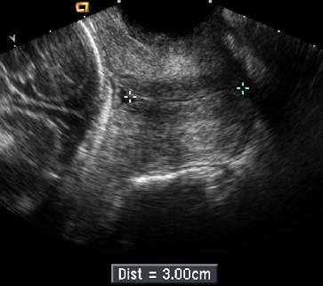 Atlas of Ultrasound in Obstetrics and