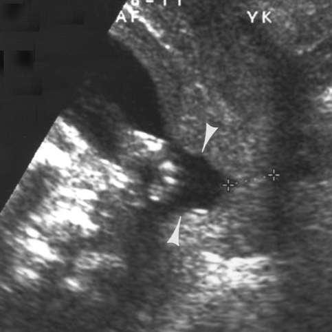 Sonography of Obstetric and Gynecologic