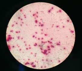 trên môi trường Ashby thạch đĩa, hình thái khuẩn lạc có đặc điểm như sau: khuẩn lạc màu trắng