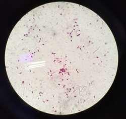 màu Gram âm, tế bào có hình que ngắn Hình 5: Chủng N161 trên môi trƣờng thạch đĩa và ảnh chụp