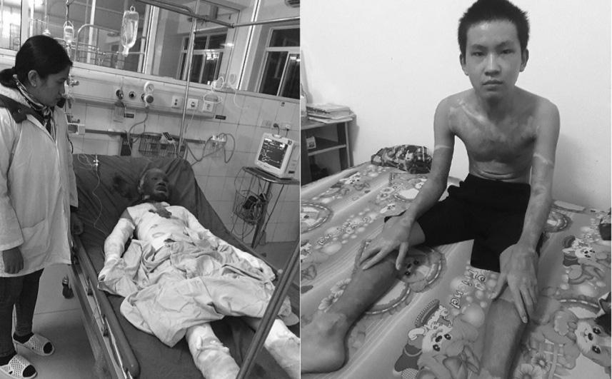 qua nhưng chị Hợi (xóm 10 xã Sơn Trường, huyện Hương Sơn, tỉnh Hà Tĩnh) vẫn không thể quên thời khắc nhận được điện thoại của gia đình báo tin con trai cả Phan Anh Tuấn bị bỏng do nổ bình gas khi