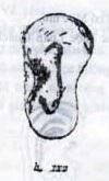 9. Tai heo (trƣ nhĩ): Hình dạng tai lớn nhƣng mộc thấp, có vành tai ngoài rất đậm nhƣng vành tai trong lại quá nhạt hoặc không có, nên tai trông thô tục, đôi khi Tai heo cũng có Thùy châu nhƣng Thùy