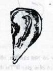 14. Tai hình quạt (phiến phong nhĩ): Tai bẹt, chiều vũm của Tai không đáng kể, vành tai mỏng cả hai tai gần nhƣ úp xuống phía trƣớc trông tƣơng tự nhƣ quạt lông thời xƣa (h117) Về phƣơng diện thành