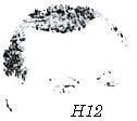 Hai góc trên của Trán nẩy nở và không có tóc tạo thành hai góc tròn khá rộng khiến phần Trán tiếp giáp với chân tóc trông giống chữ M (h.
