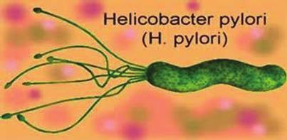 pylori tiết ra một enzym là urease làm chuyển đổi urea thành ammonium. Sự sản xuất ra ammonium quanh H. pylori làm trung hòa độ acid của dạ dày, làm cho con vi khuẩn dễ sống hơn.