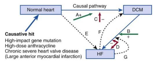 Mô hình bệnh: BCTDN và suy tim (Disease model: dilated cardiomyopathy and heart failure) B +, A + : Factors accelerate causal