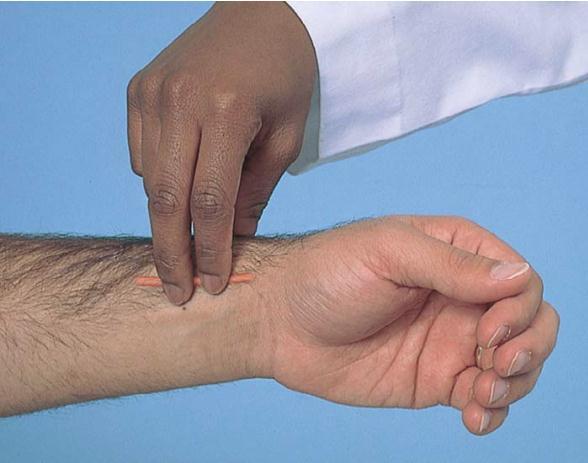 4. Khám mạch máu chi trên: Nhìn: cả hai tay từ ngón tay đến vai: - Kích thước cân đối của hai chi phù hay không.