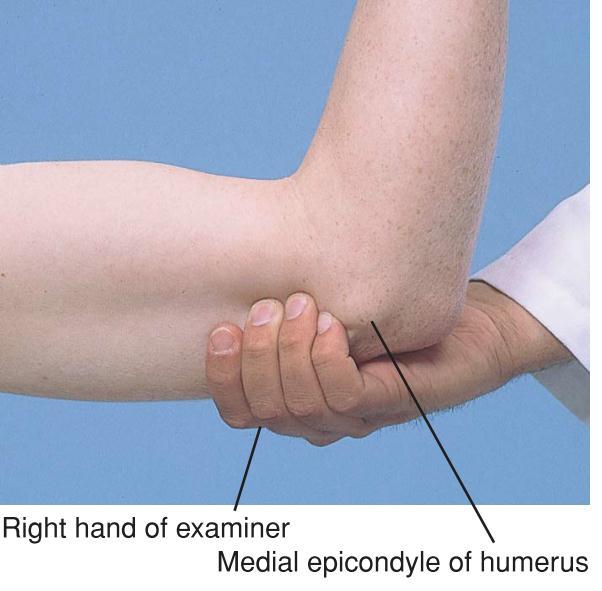 4. Khám hạch vùng khuỷu tay: Nâng cẳng tay khoảng 90 độ, các ngón tay tìm hạch giữa cơ
