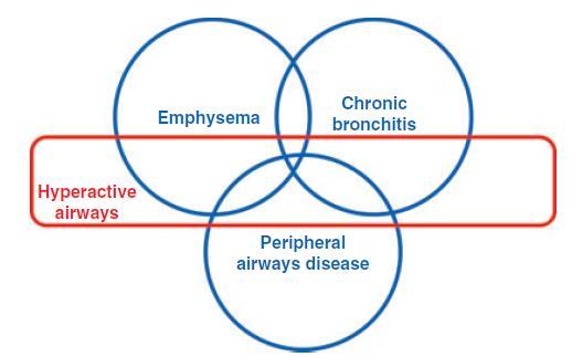 Ba thể bệnh của bệnh phổi mạn tắc nghẽn TL: Estrada Y Martin RM, Brown SD.