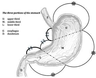 3 Chương 1 TỔNG QUAN 1.1. GIẢI PHẪU DẠ DÀY 1.1.1. Hình thể ngoài Dạ dày là đoạn phình to nhất của ống tiêu hóa, nối giữa thực quản và tá tràng, nằm sát dưới vòm hoành trái, ở sau cung sườn trái và vùng thượng vị trên.