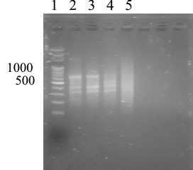 electrophoresis in 1 % agarose gel in TAE buffer and stained with ethidium bromide. The expected size of PCR products were 668 bp for NA type and 645 bp for EU type.