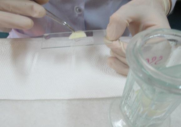 Vớt lam kính, nhỏ DAPI lên lam kính, sau đó nhỏ antifate để bảo vệ tế bào khỏi tia huỳnh quang, đậy lamelle đem đọc phân tích dưới kính hiển vi. Hình 23. Cho vào máy lai PCR Hình 24.Gỡ keo sau lai 2.