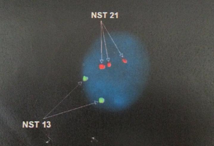 tia huỳnh quang NST 21 bắt màu đỏ.