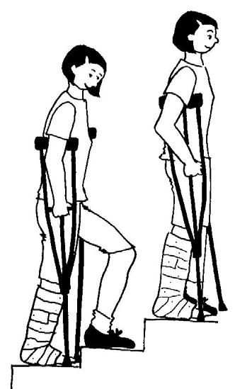 When walking with crutches, put the crutch tips about 2 to 3 inches out to the side and about 1 foot ahead of you.