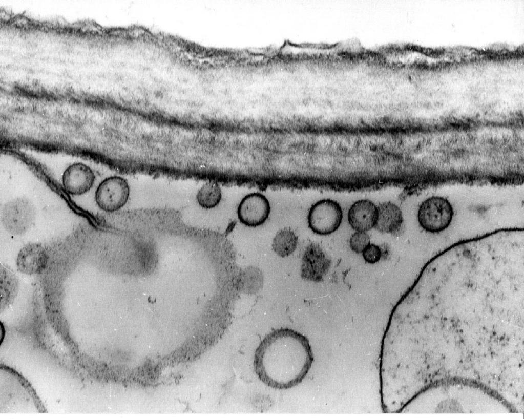 nh 12: Phytoplasma trong tõ bµo c y mýa