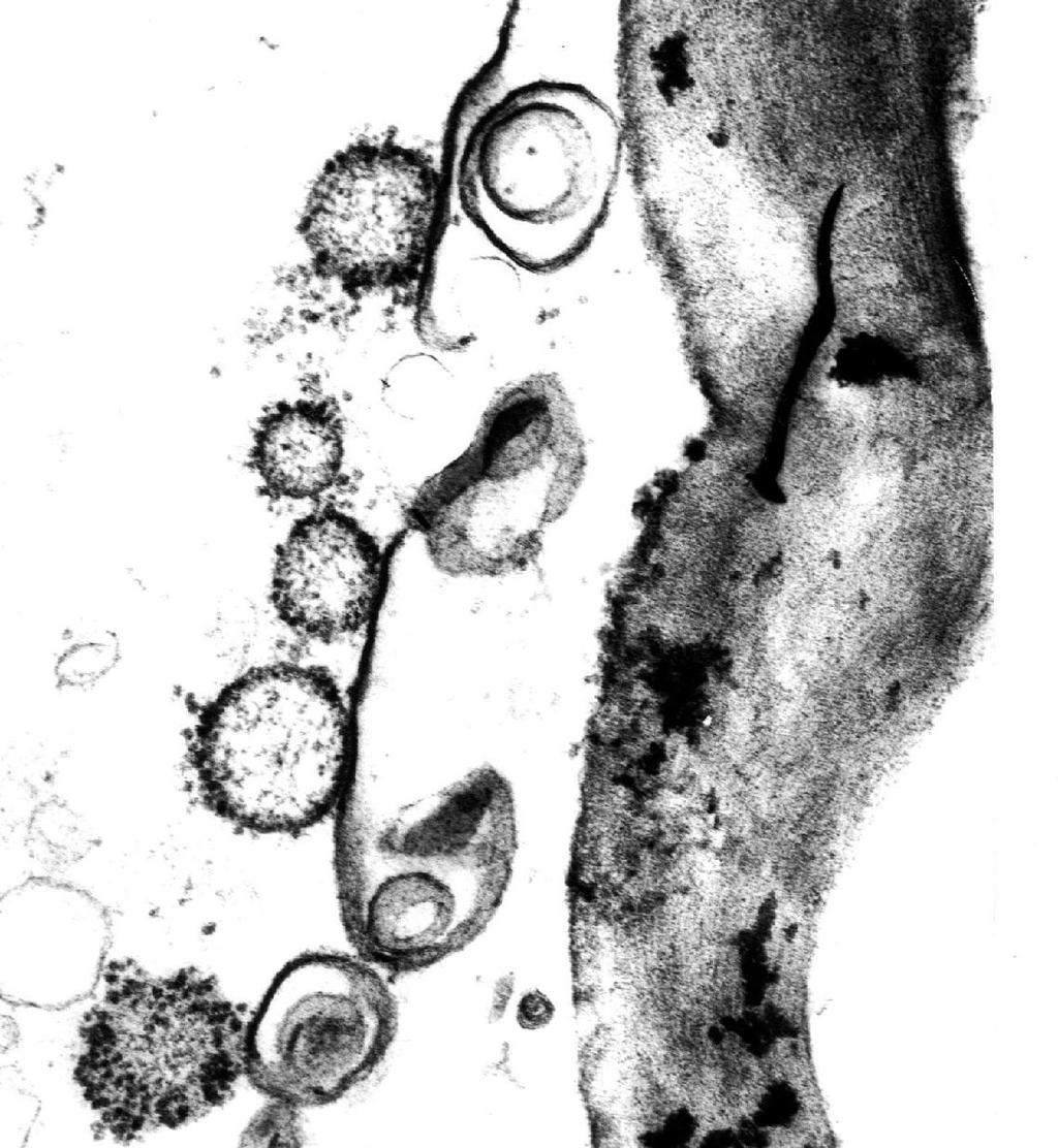 nh 14: Phytoplasma trong tõ bµo c y cµ phª vµng l