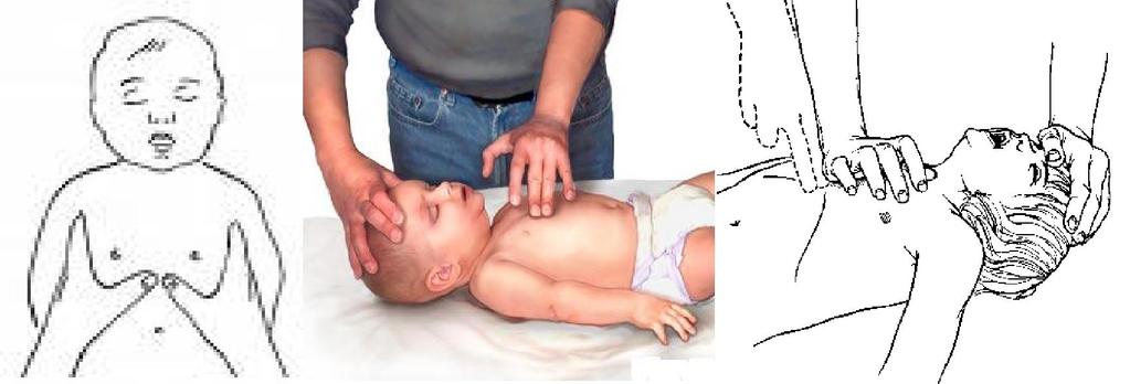 Nếu có mạch đầy đủ tần số và dấu hiệu tưới máu tốt mà trẻ vẫn ngừng thở thì phải tiếp tục thổi ngạt cho đến khi trẻ thở lại.