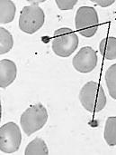 37 Khối bào tương nhỏ, đường kính 2-3 m hình cầu hay hình trứng sinh ra từ tế bào nhân khổng lồ của tủy tạo huyết.