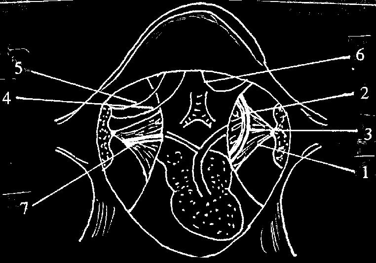 + Tìm dây thần kinh X: Sau khi mở lồng ngực, không nên cắt ngang các tổ chức ở lớp trên sát với thành ngực, mà dùng thông có rãnh tách các dây thần kinh dưới lưỡi và lưỡi hầu ra để không nhầm với dây