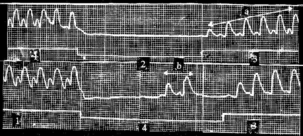 Hình 8: Ảnh hưởng của dây thần kinh X lên hoạt động của tim ếch. 1. Hoạt động tim bình thường; 2 và 4. Ảnh hưởng của kích thích dây X lên tim; 3. Hoạt động của tim sau ngừng kích thích dây X.