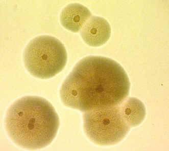 Căn bệnh Mycoplasma Không có thành tế bào đề kháng kháng sinh nhóm beta-lactam (penicillin, amoxcillin, ampicilin) Có khả năng ngưng kết hồng cầu Hầu hết các chất sát trùng đều có hiệu quả đối với MG