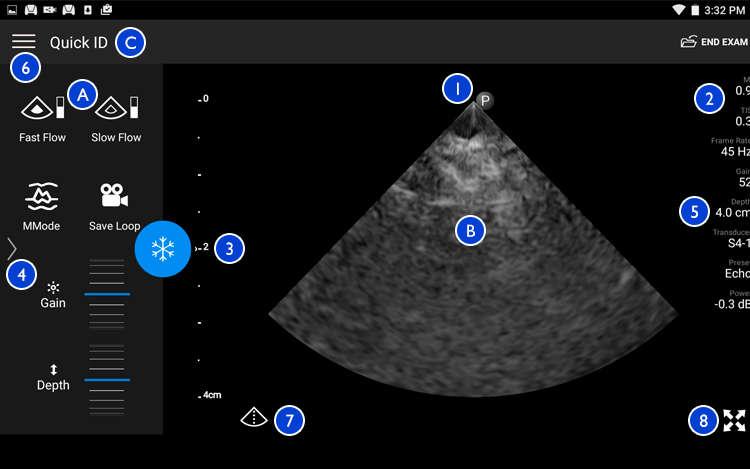 Màn hình siêu âm Sử dụng hệ thống Màn hình siêu âm (Hướng ngang) A Khu vực điều khiển B Vùng hình ảnh C Thông tin bệnh nhân 1 Chỉ dấu hướng mặt phẳng siêu âm 2 Giá trị MI và TI 3 Đèn chỉ báo hội